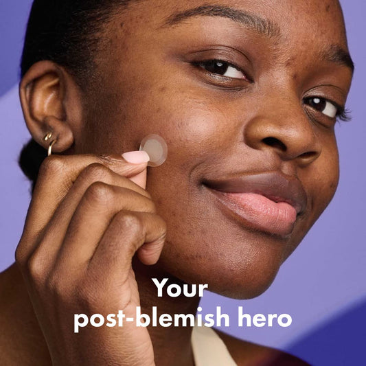 Mighty Patch on skin demonstrating dark spot coverage and alignment