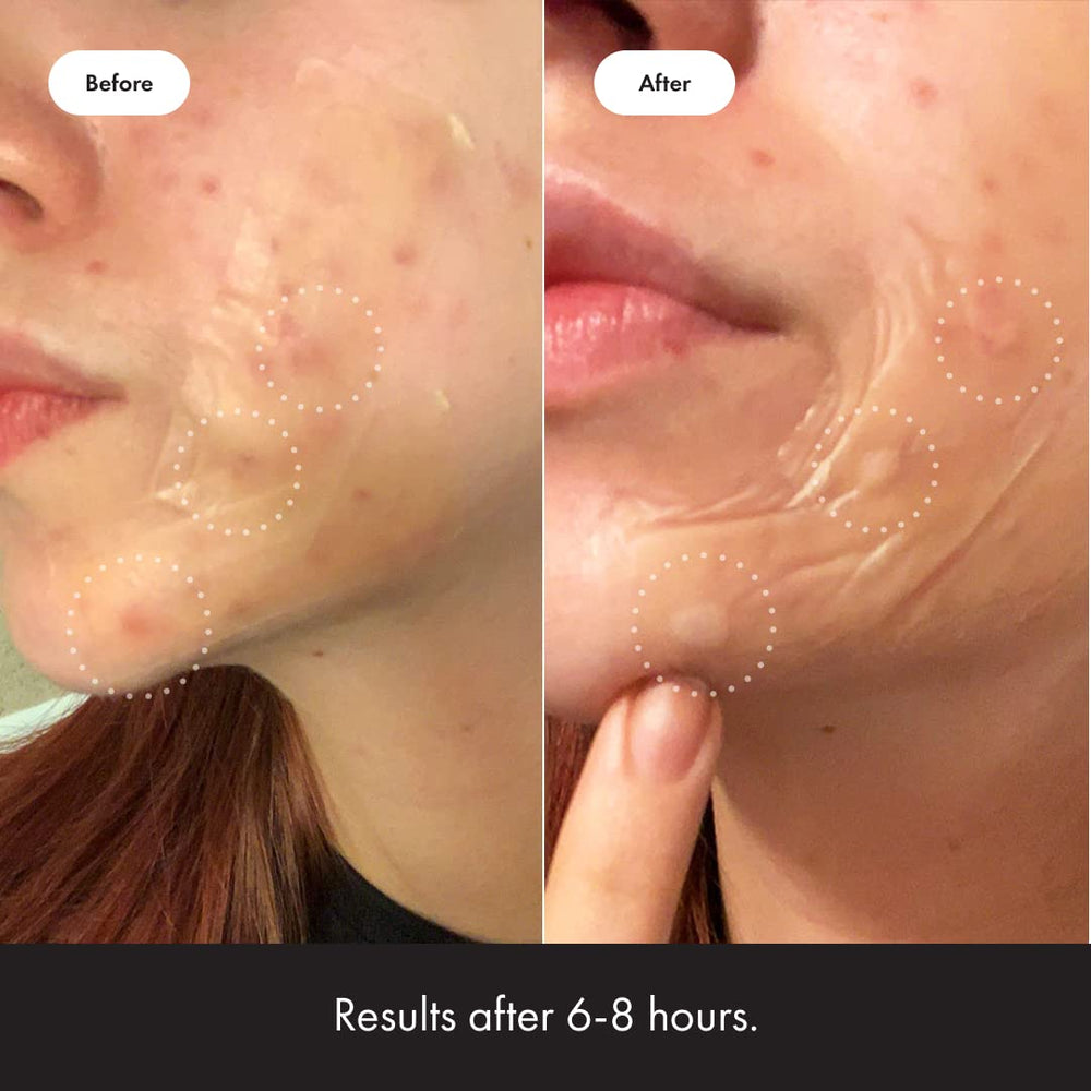 Mighty Patch Surface along neck and jawline fits contours