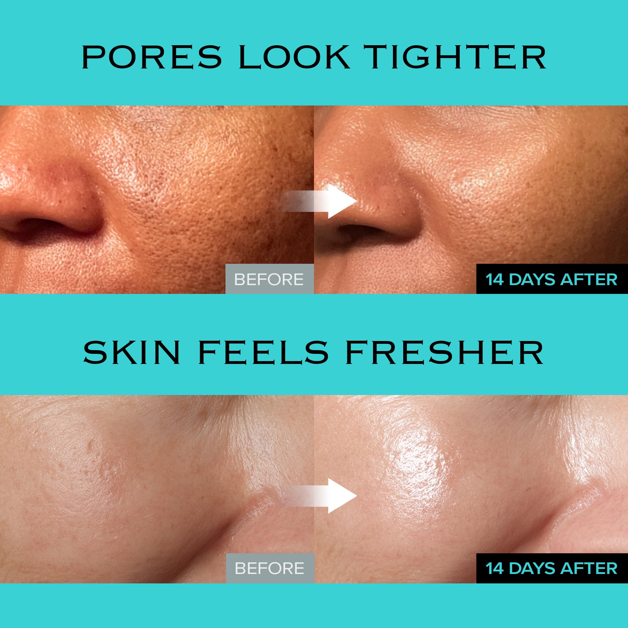 mimmua Ice Sorbet gel-cream in hand illustrating sebum control.