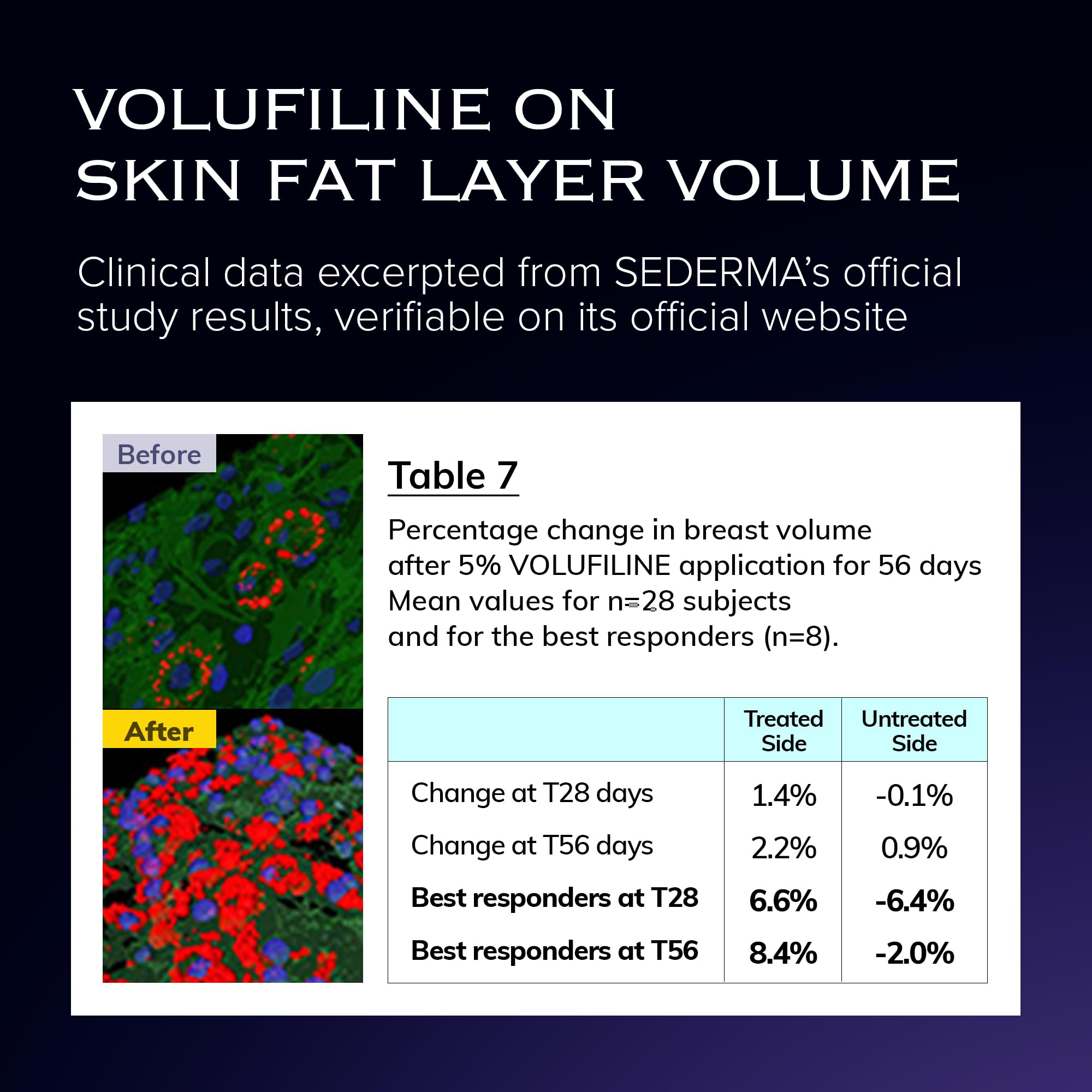 Eye area target image illustrating Volume UP for delicate skin.