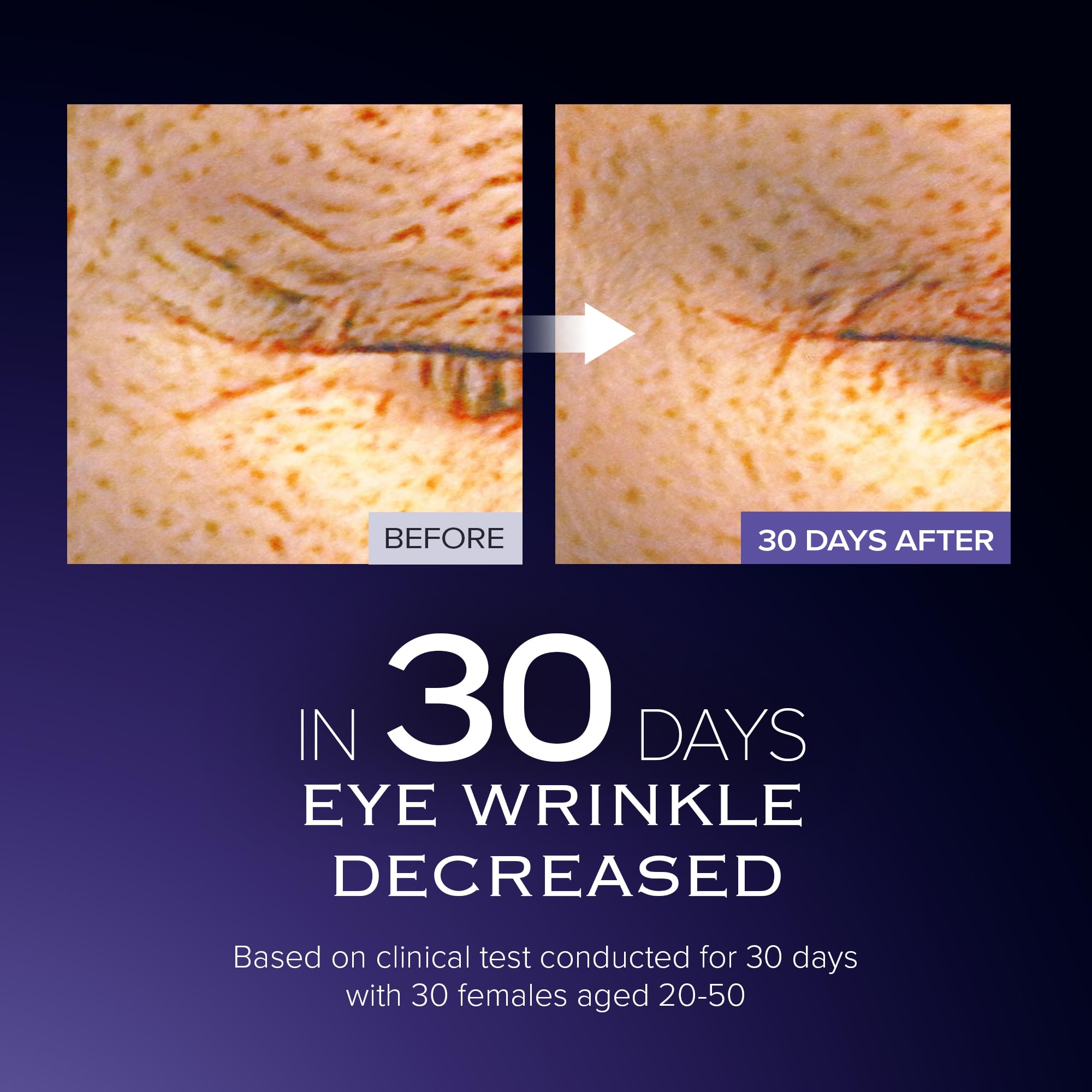 Face application area demonstrating Volume UP use on targeted zones.