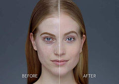 Porcelain shade delivering a smooth, natural look