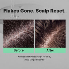 MINOXELL lather ready for deep cleansing of scalp