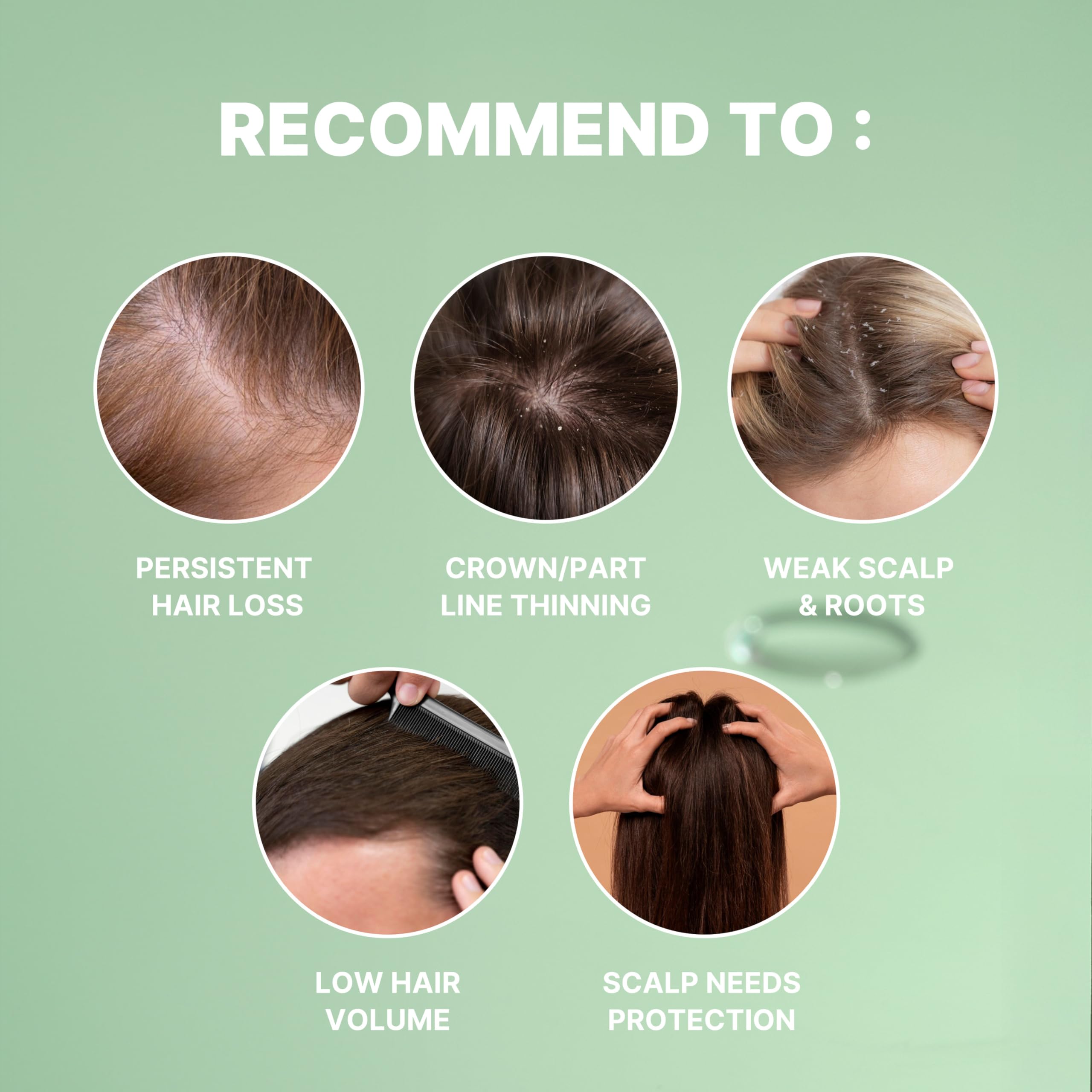 MINOXELL Lightweight formula absorbs quickly for daily scalp care.