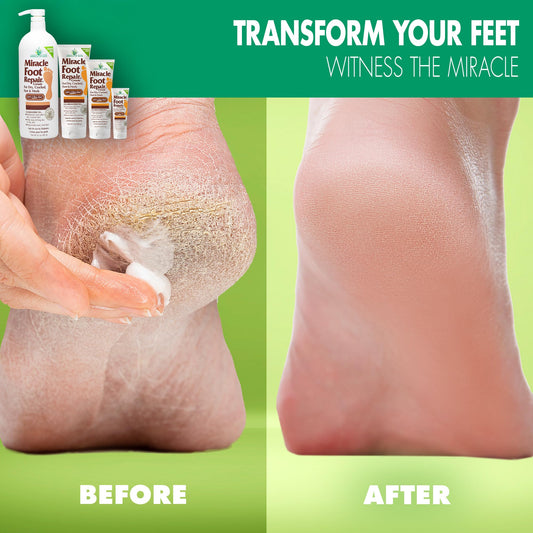 Miracle of Aloe 60 percent Ultra Aloe formula shown for deep moisturizer