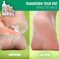 Texture close-up of Miracle of Aloe foot repair cream for quick absorption.
