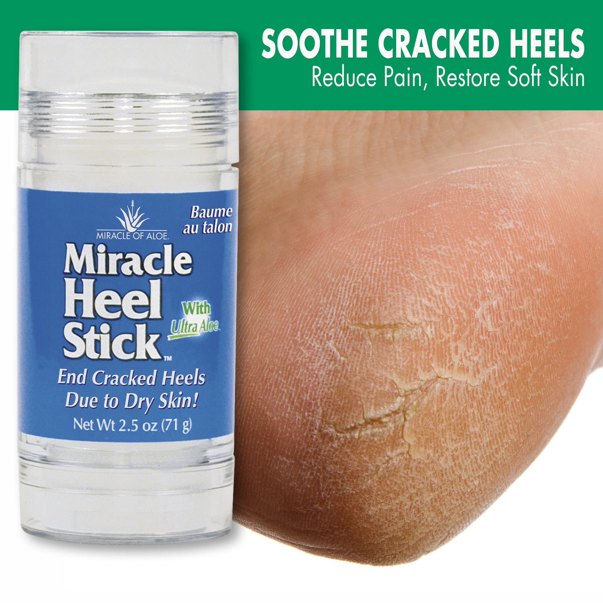 Miracle of Aloe heel stick in use applying to cracked heel for targeted moisture