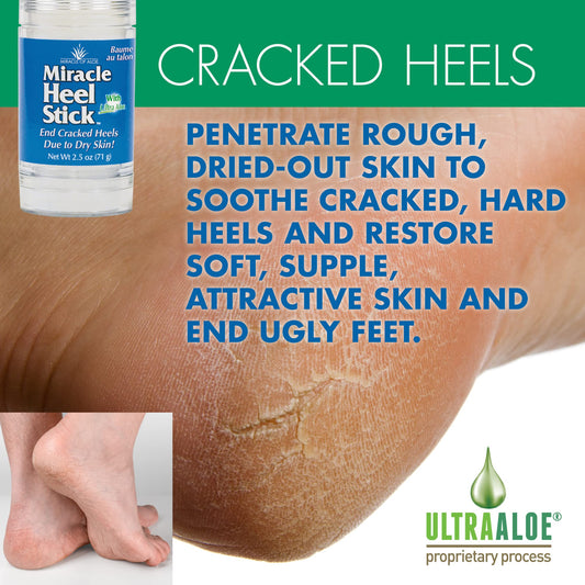 Miracle of Aloe Heel Stick packaging close-up highlighting portable design.