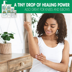 Hands applying Miracle of Aloe on knees and elbows for dry patches
