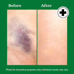 Gel quickly absorbs with a non-greasy feel