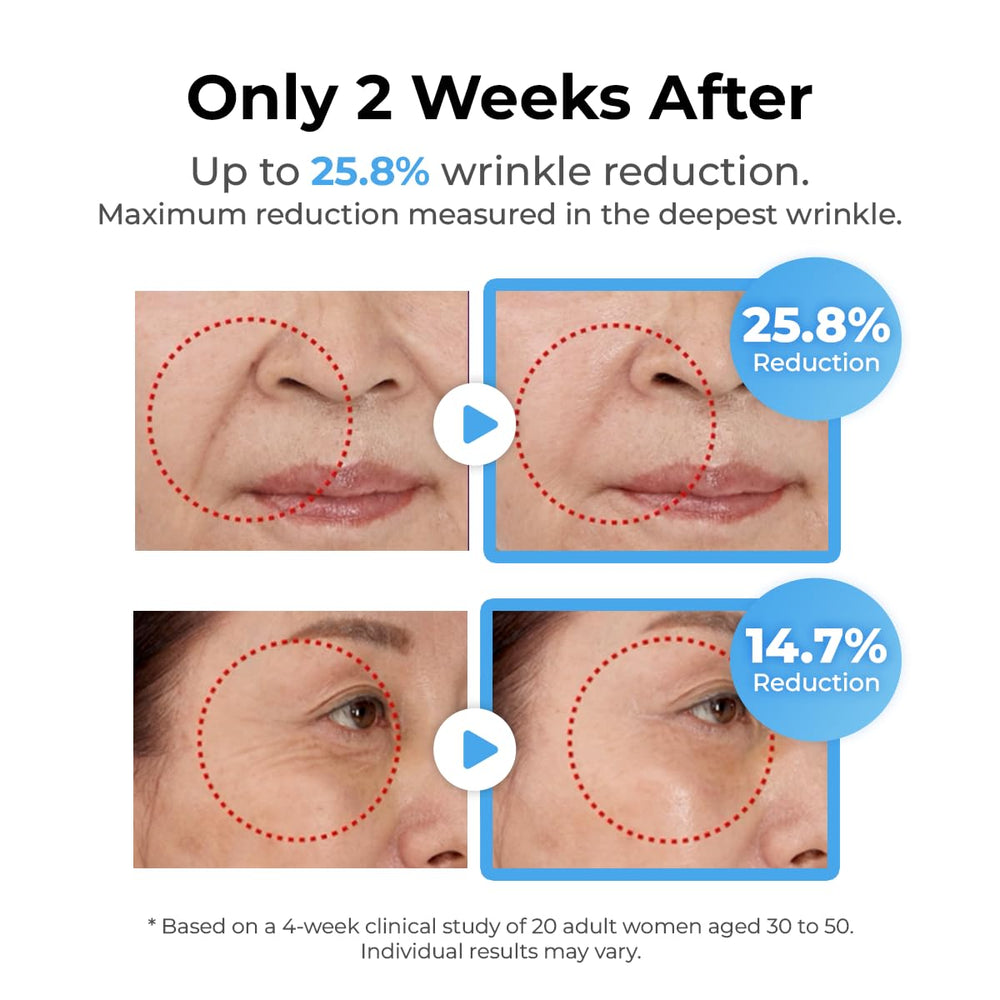 Miss Myer SnowTox serum dropper dispensing formula for targeted wrinkle care.