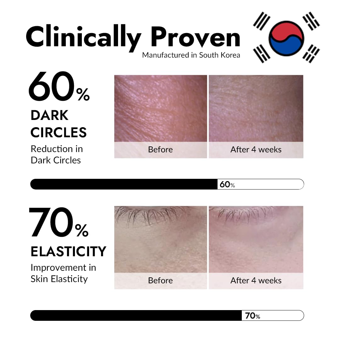MIZON under-eye patches applied showing hydrating, plumping effect