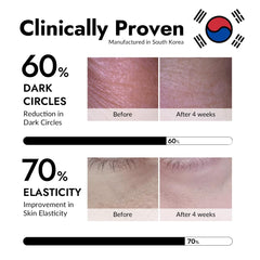 MIZON under-eye patches applied showing hydrating, plumping effect