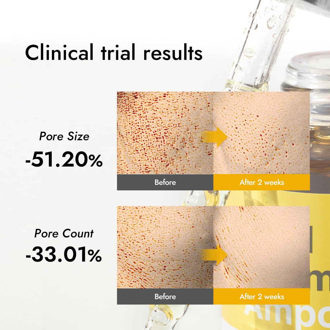 MIZON Real Vitamin C Ampoule packaging detail and label clarity.