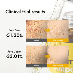 MIZON Real Vitamin C Ampoule packaging detail and label clarity.