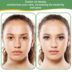 MMPANG Castor Oil dropper-cap for precise application.