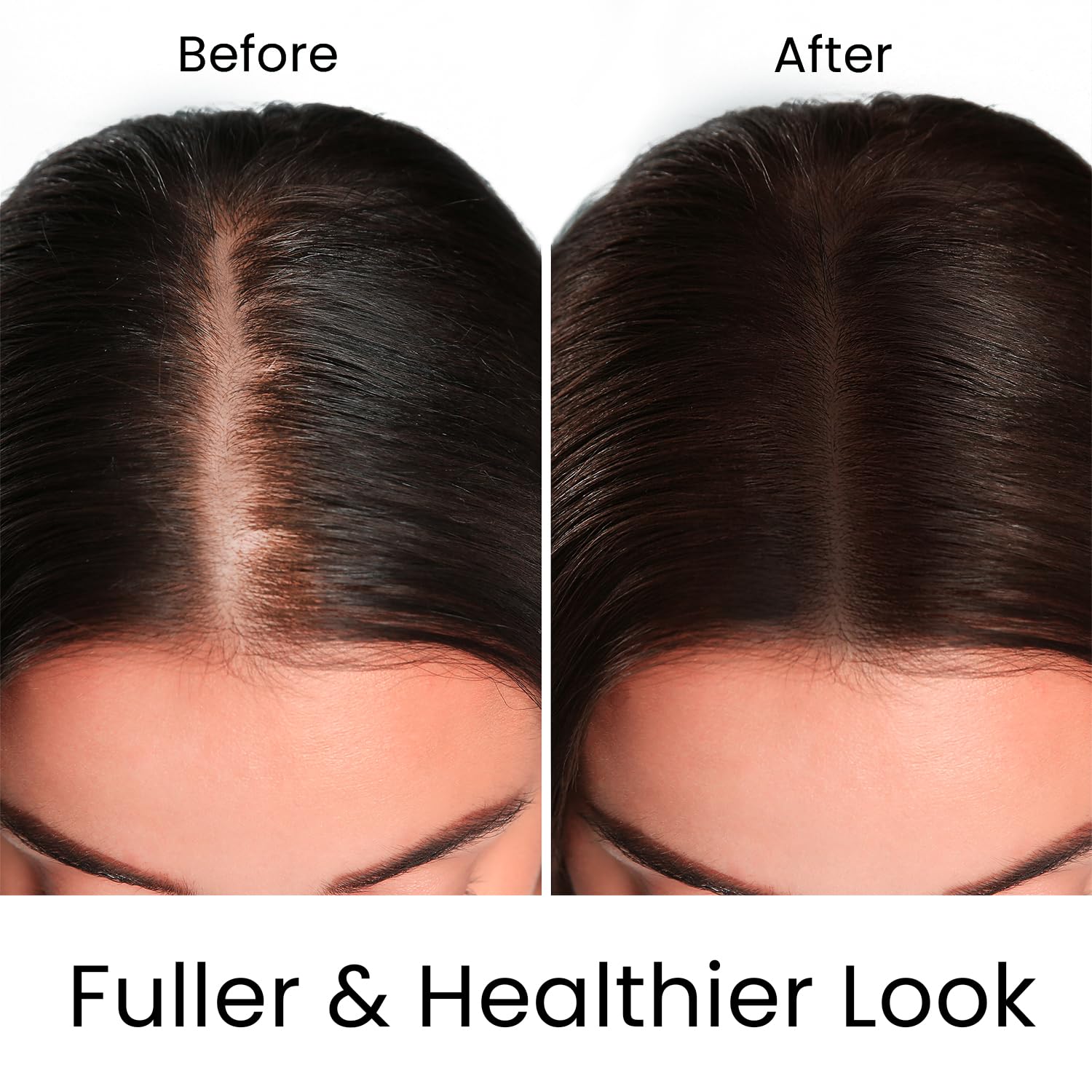 MOEHAIR Hair Guard Shampoo root stimulation supports healthier roots.