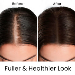 MOEHAIR Hair Guard Shampoo root stimulation supports healthier roots.