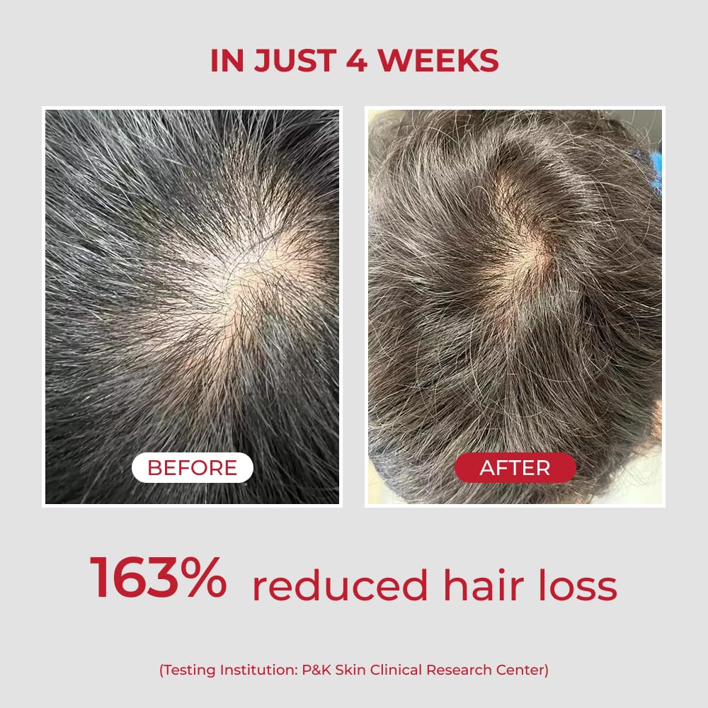 Biotin nutrition focus in MOEV ANNURCATIN formula for roots