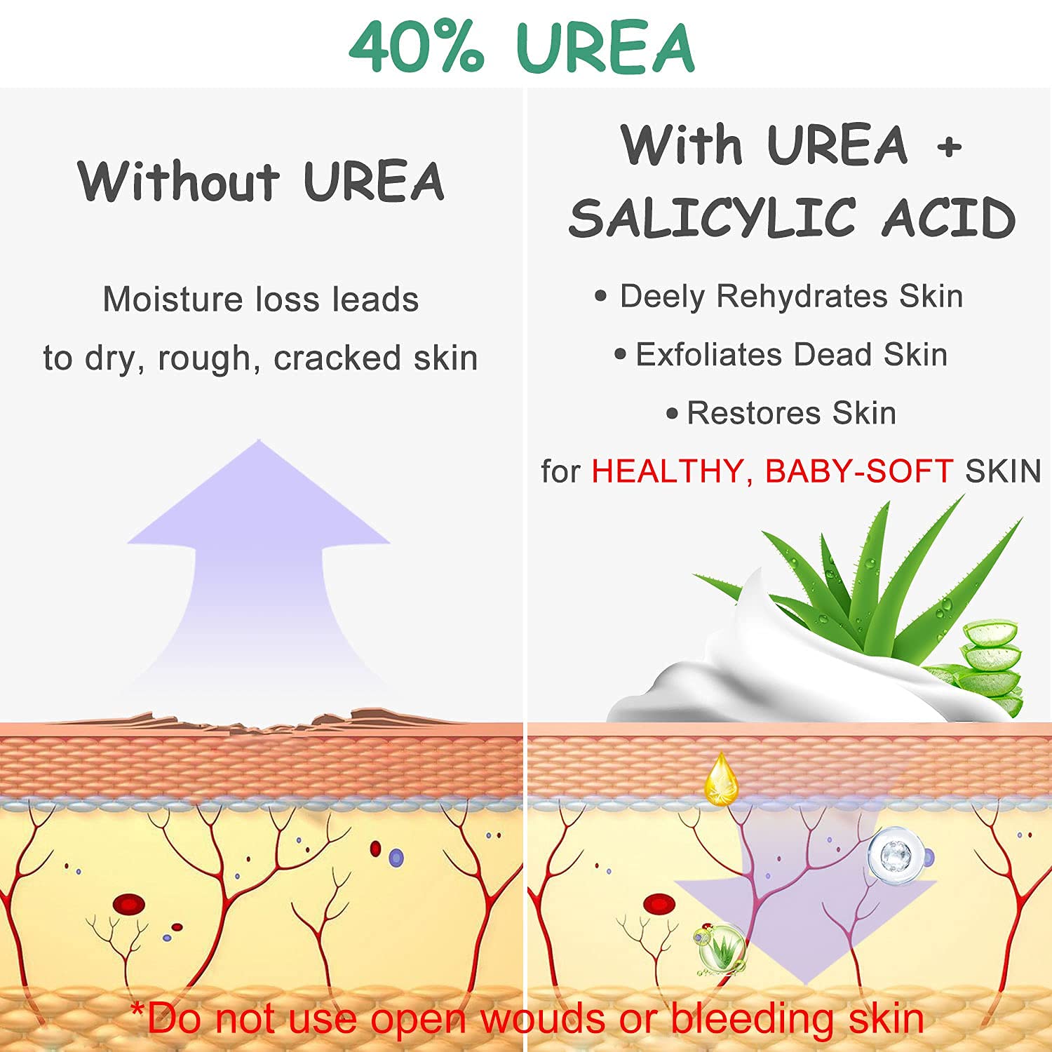 MOKYDUO Urea 40% foot cream in hand for easy application.