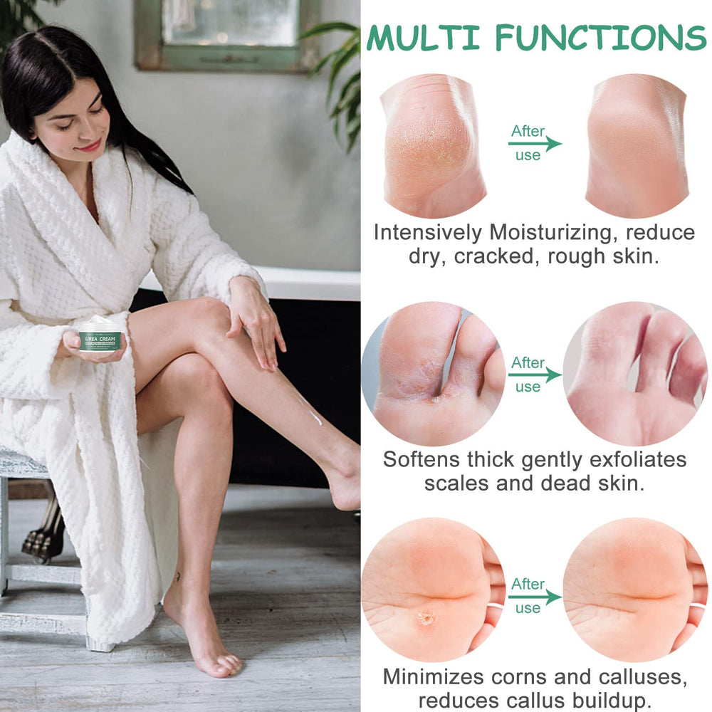 MOKYDUO Urea 40% foot cream on heels for smoother skin.