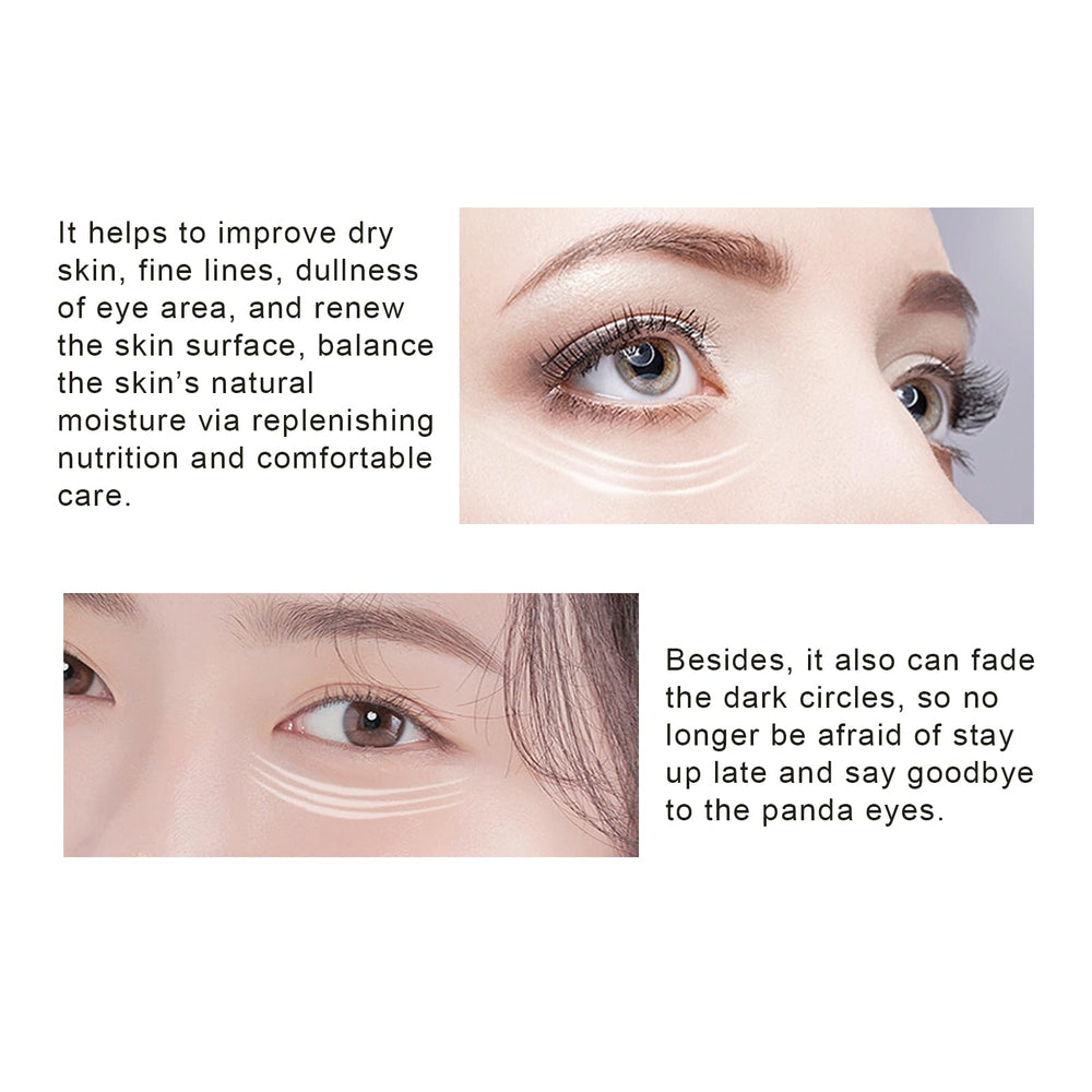 MOND'SUB ongoing use may hydrate and refresh the under-eye skin.