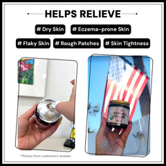 Moo Ranch whipped tallow hand application demonstrates soothing moisture for rough skin.