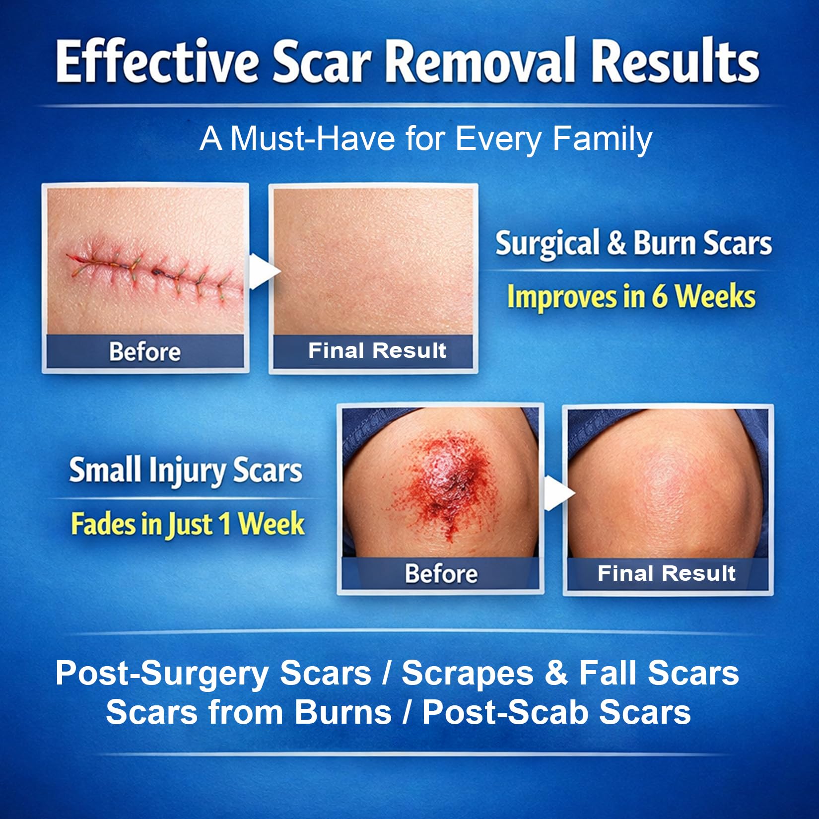 Morovan silicone scar gel applying on skin demonstrates comfortable, quick-dry application