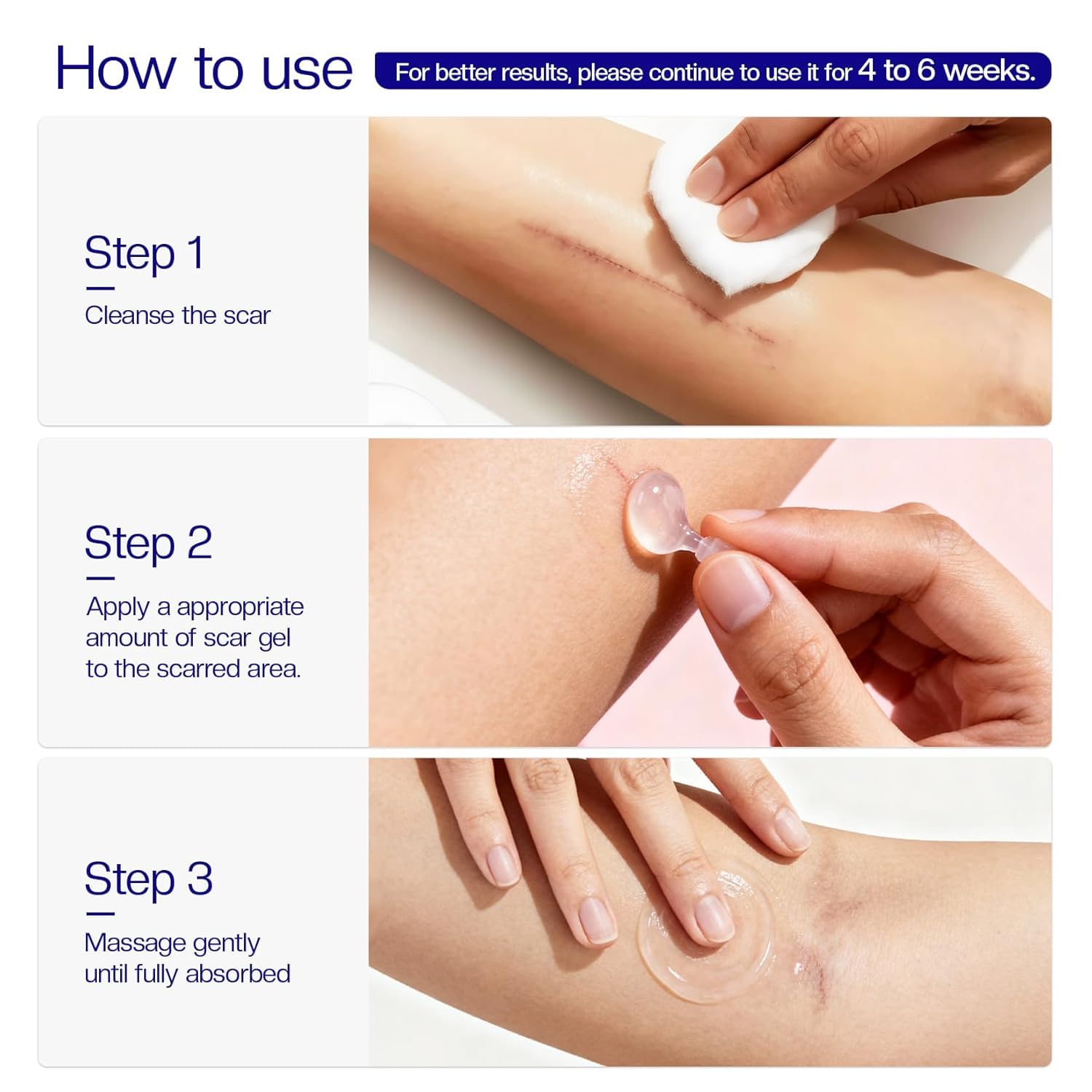 Morovan silicone scar gel protectively envelopes skin during healing process