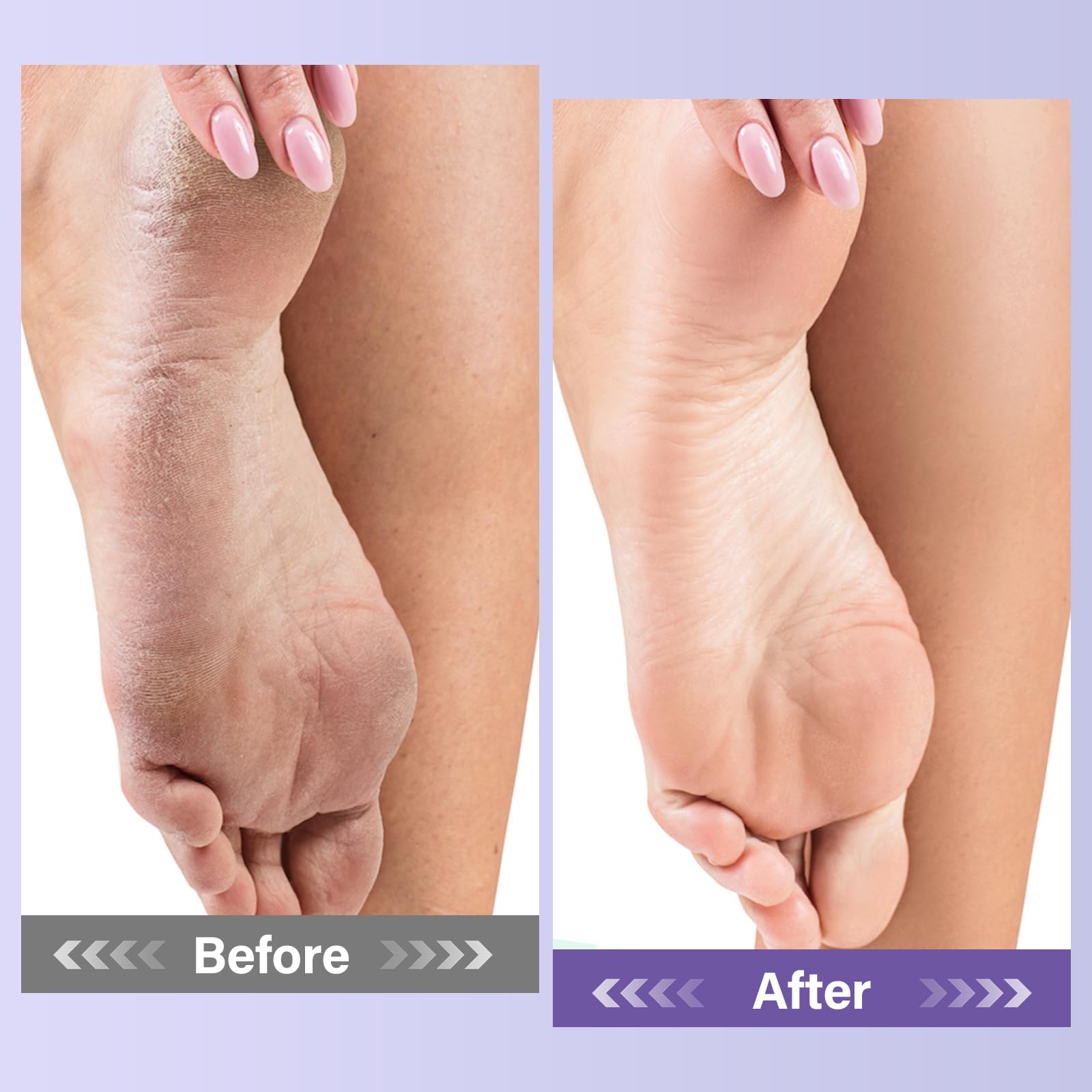 MOSRROU Gift-ready foot care kit ideal for birthdays and holidays