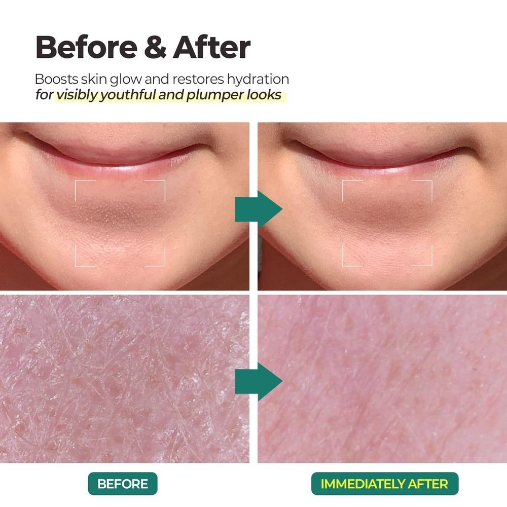 MOTHER MADE LHA Green Tea Aqua Peel Gel aids pore refinement