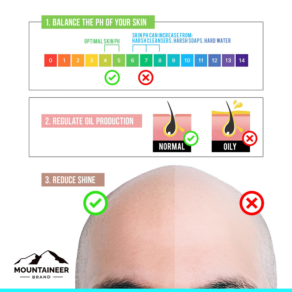 Before and after showing reduced shine on a bald head.