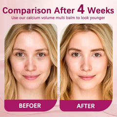 MQN Calcium Stick used on the neck to hydrate and smooth skin.