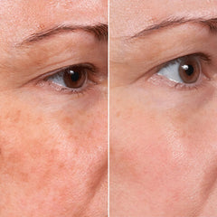 MSGBcg Ageless serum being applied to skin during a quick facial massage.