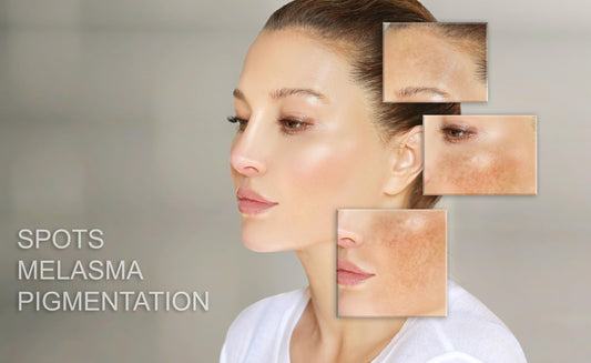 MT SKIN CLINIC Pro Intense jar closeup showing rich texture for daily hydration.