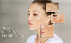 MT SKIN CLINIC Pro Intense jar closeup showing rich texture for daily hydration.