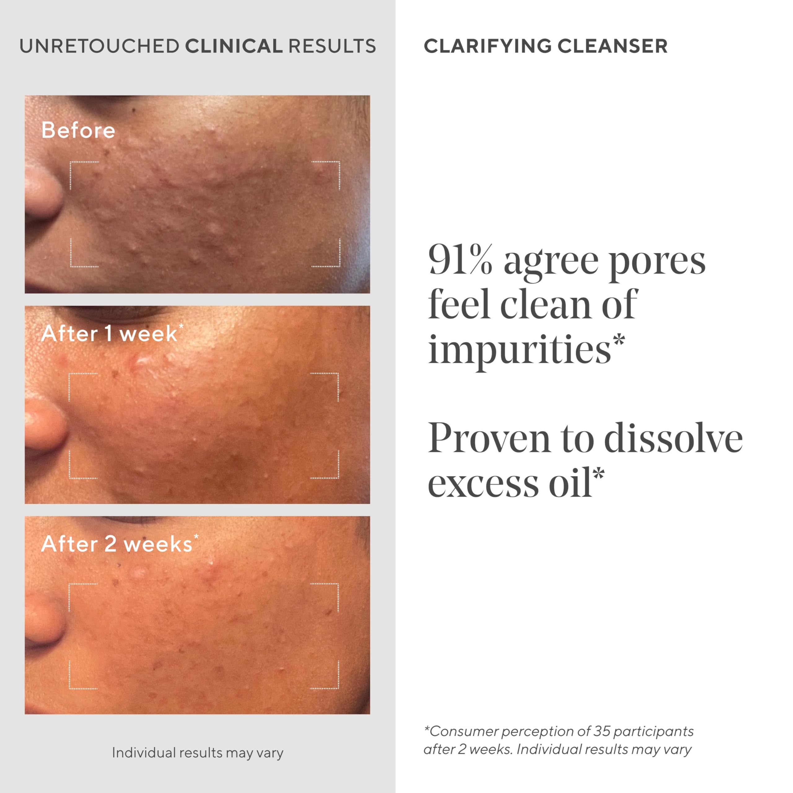 Murad Acne Control Clarifying Cleanser label close-up with ingredients