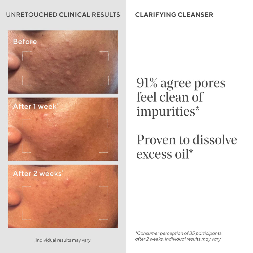 Murad Acne Control Clarifying Cleanser label close-up with ingredients