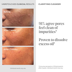 Murad Acne Control Clarifying Cleanser label close-up with ingredients