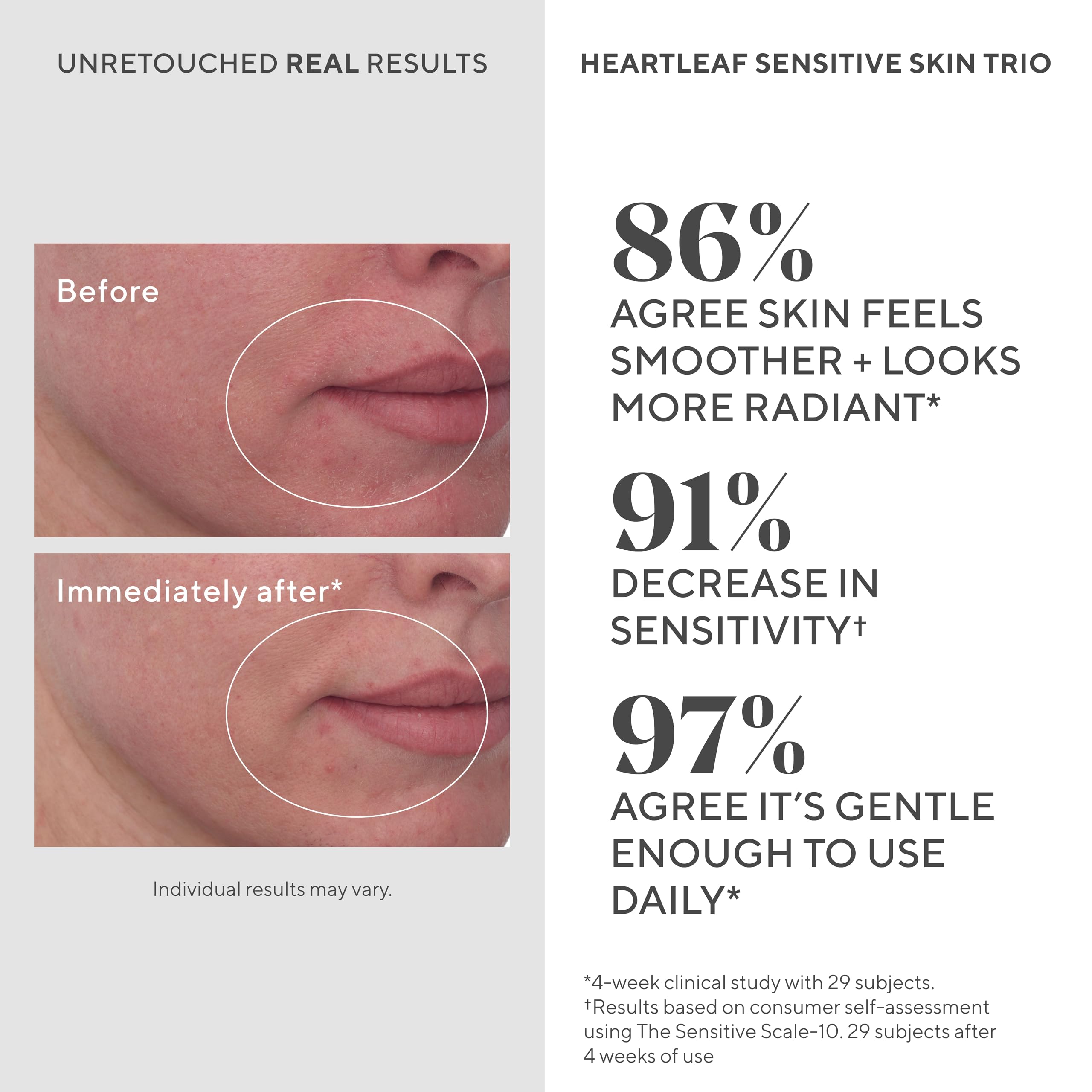 Murad Heartleaf Cleanser lather close-up highlights soft, non-stripping foam.