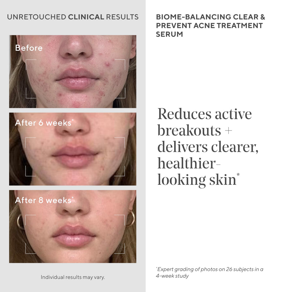 Murad Mandelic acid smooths and evens complexion in close-up.