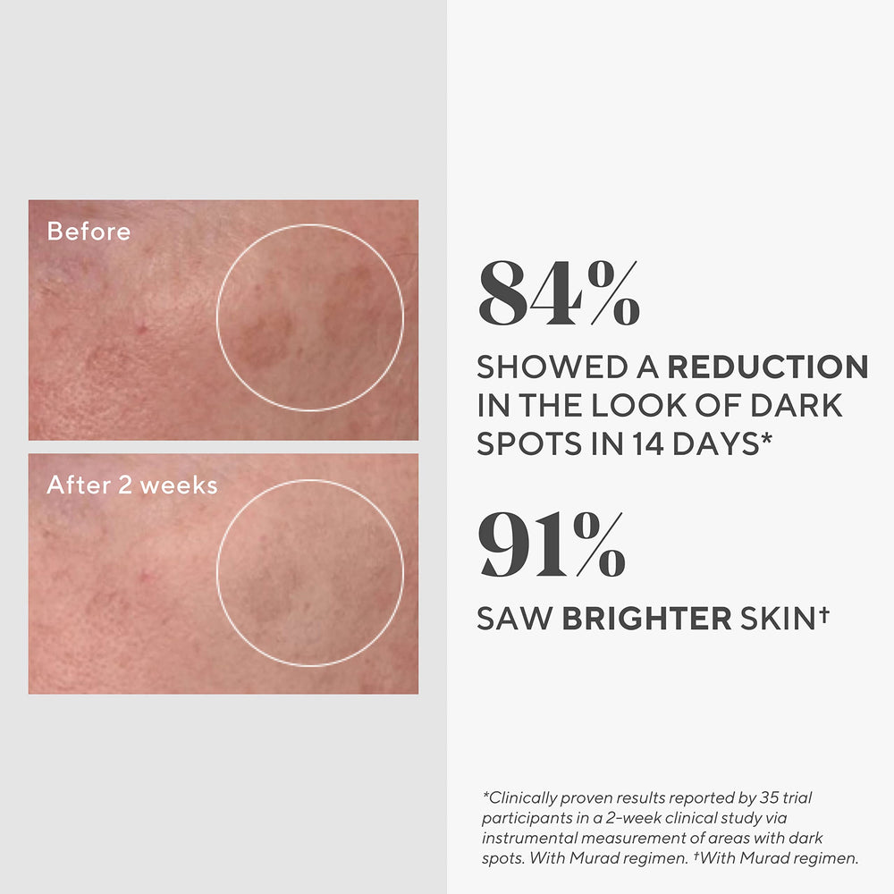 Murad Rapid Dark Spot Correcting Serum on skin demonstrates quick absorption