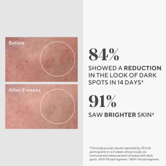 Murad Rapid Dark Spot Correcting Serum on skin demonstrates quick absorption