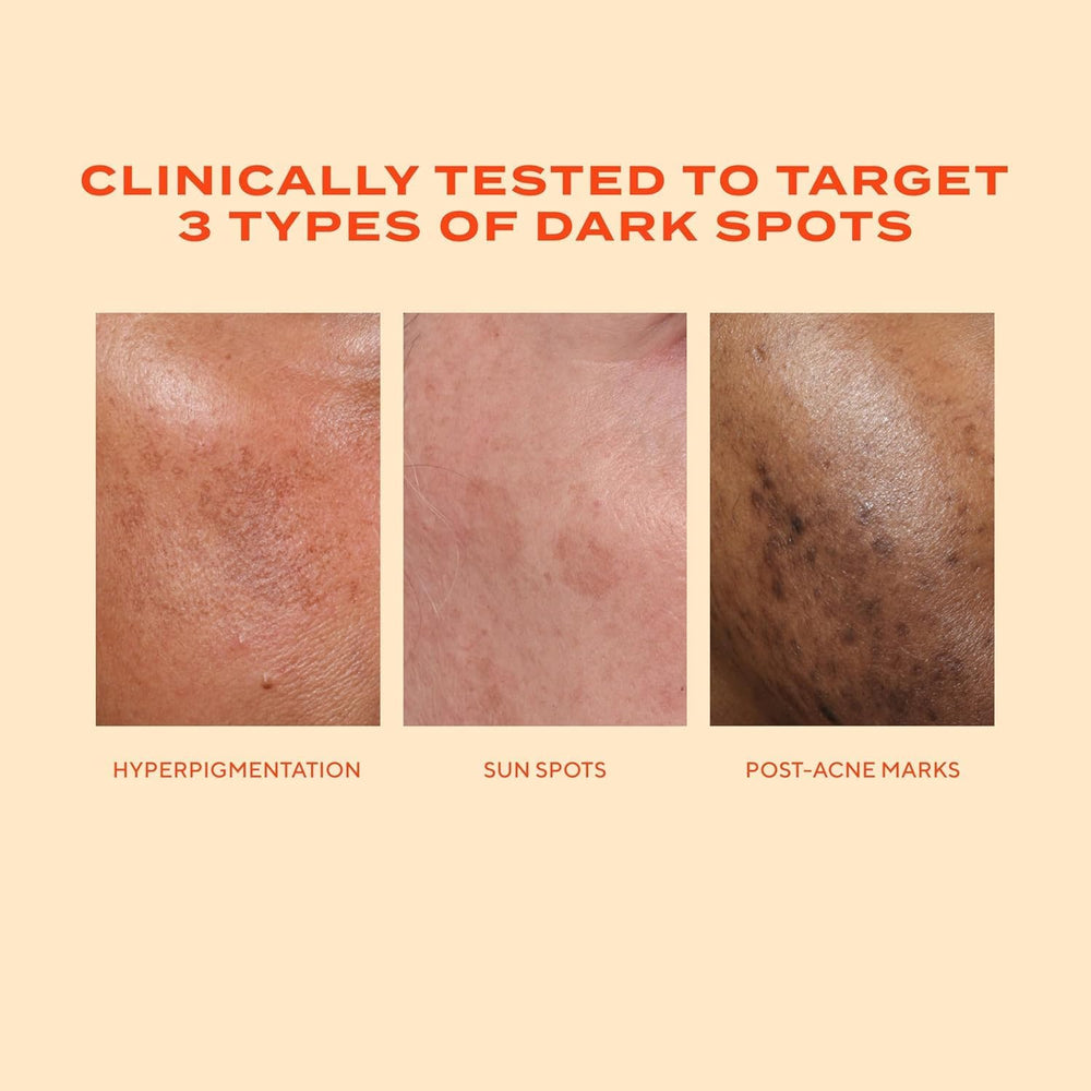 Ingredient icons showing resorcinol, tranexamic, and glycolic acids