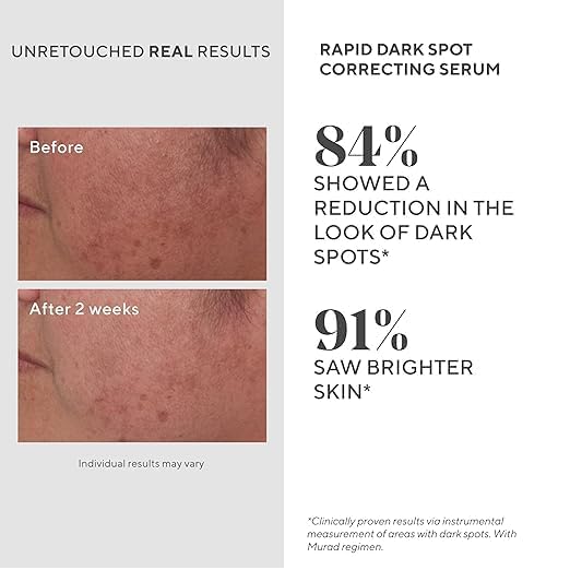 Murad Rapid Dark Spot Serum on the neck for uniform brightness