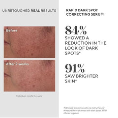 Murad Rapid Dark Spot Serum on the neck for uniform brightness