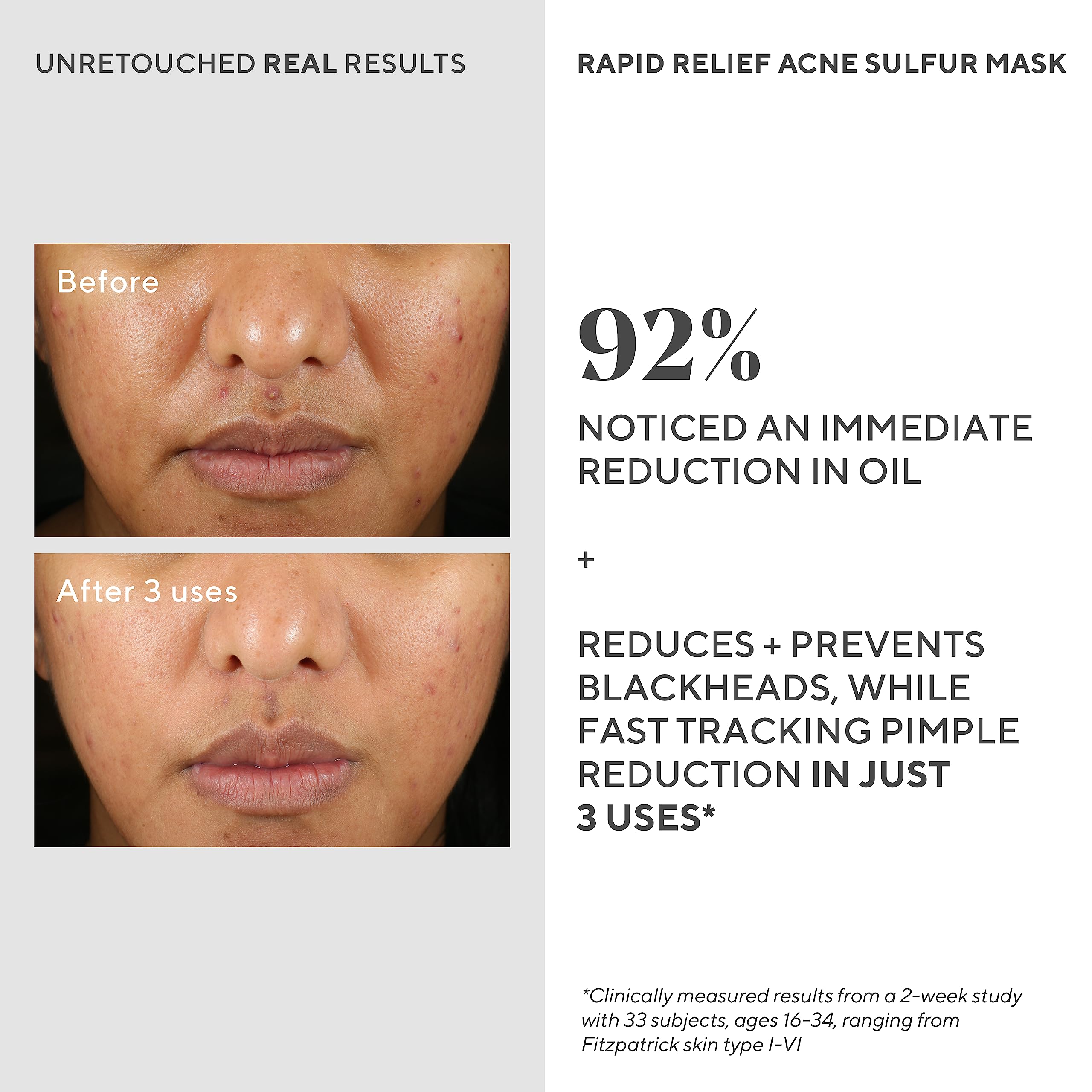 Murad Rapid Relief mask dries on skin in about 10-15 minutes