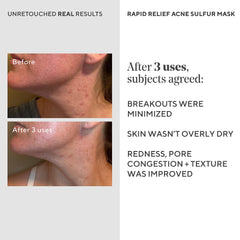 Eucalyptus-scented note balances the sulfur aroma in Murad mask during use