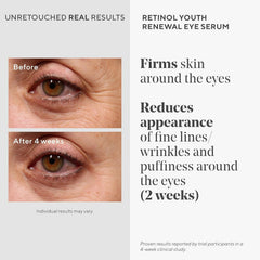 Murad Youth Renewal Night Cream jar, overnight hydration and renewal.