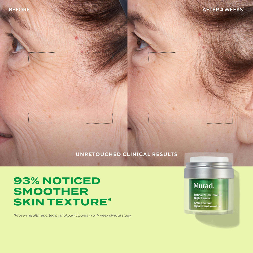 Murad Youth Renewal Serum dispensing dropper enables precise application.